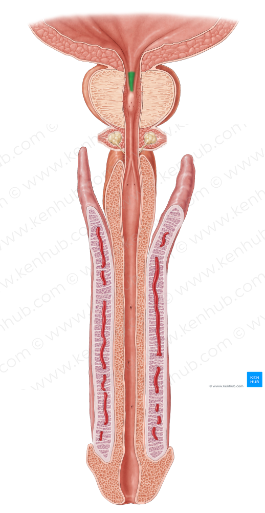 Urethral crest (#3144)