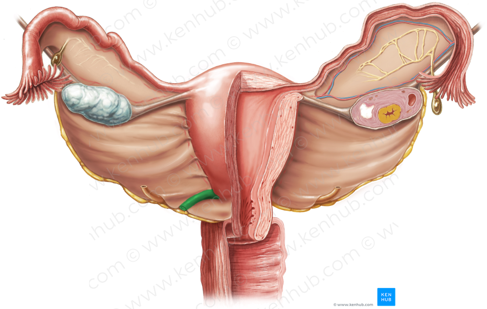 Uterosacral ligament (#4617)