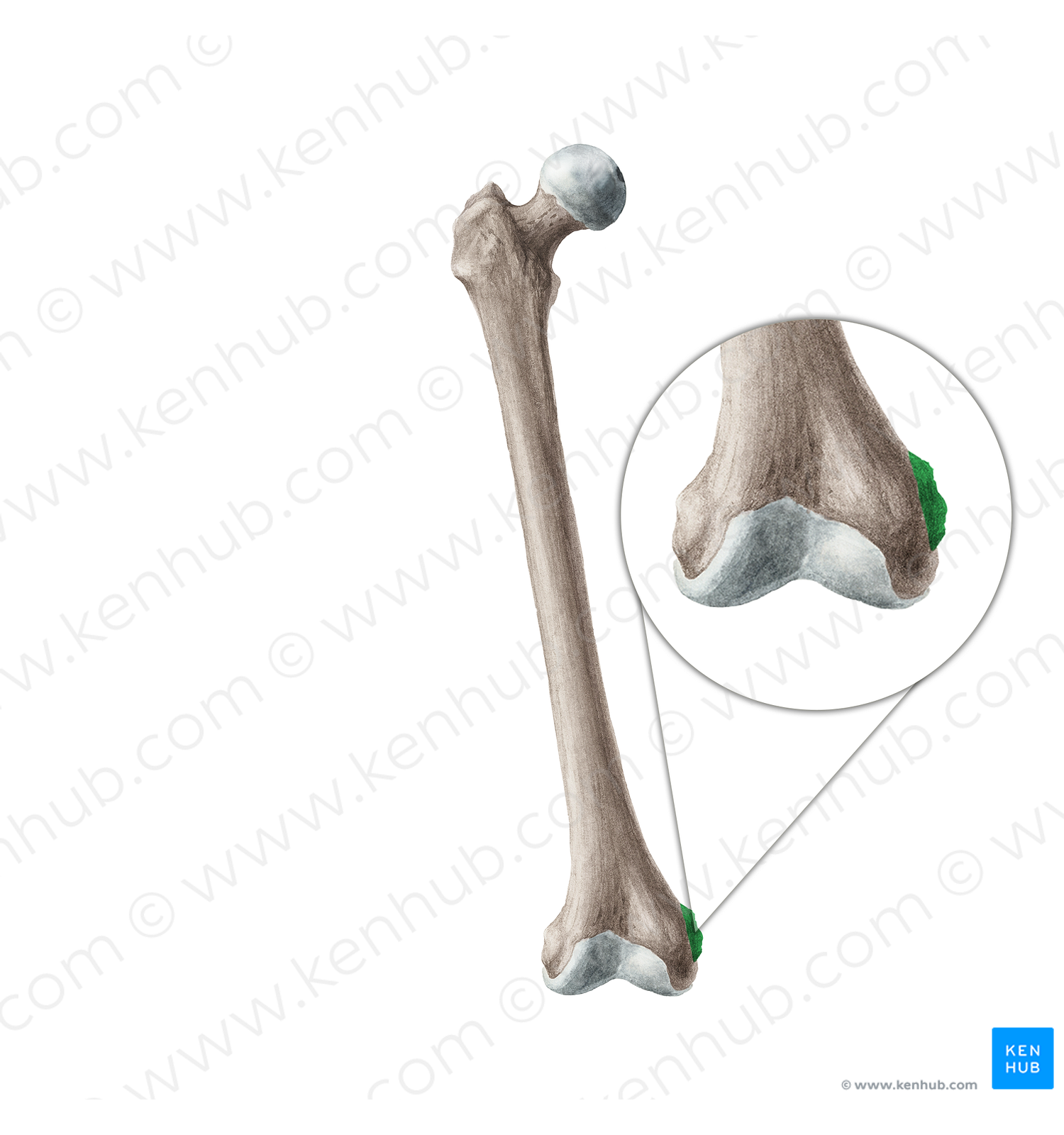 Medial epicondyle of femur (#3399)