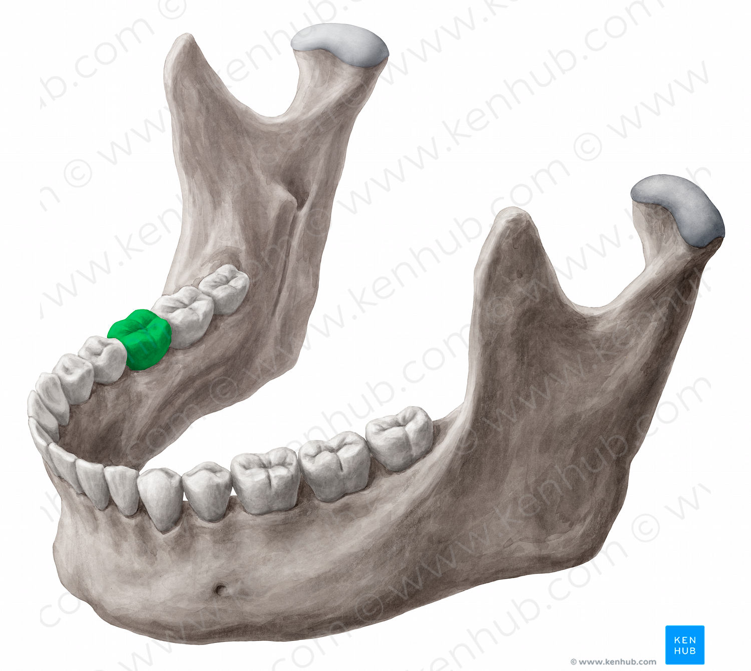 Mandibular right first molar tooth (#12856)