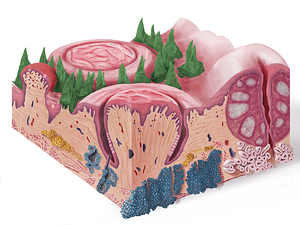 Filiform papillae (#7626)