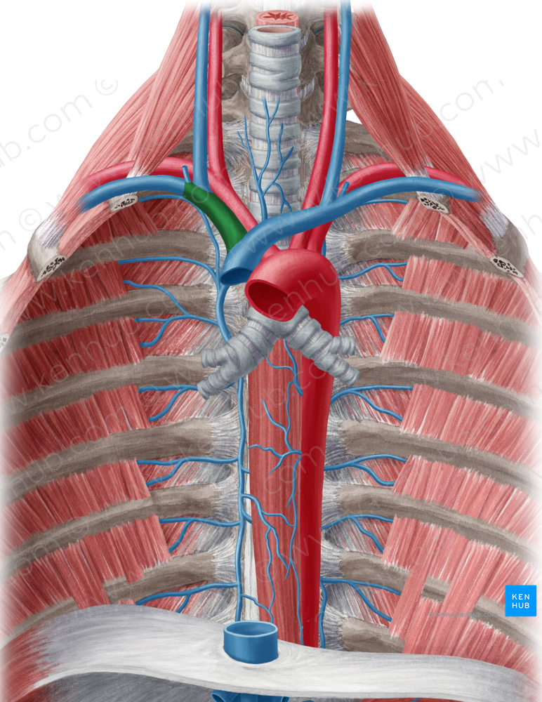 Right brachiocephalic vein (#10004)