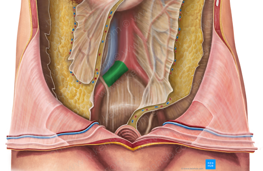 Right common iliac artery (#1379)