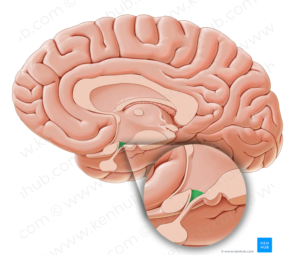 Infundibular recess of third ventricle (#8843)