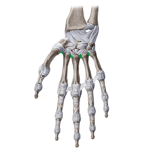 Palmar metacarpal ligaments (#19990)