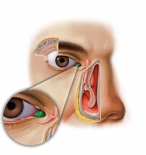 Lacrimal caruncle (#11611)