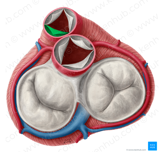 Left semilunar leaflet of pulmonary valve (#9928)