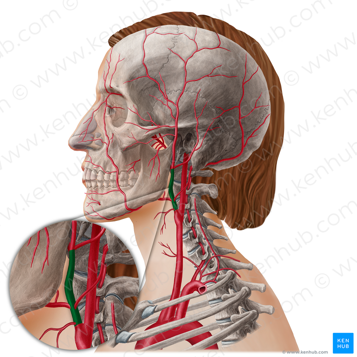 External carotid artery (#21788)