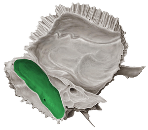 Groove for sigmoid sinus of temporal bone (#9322)