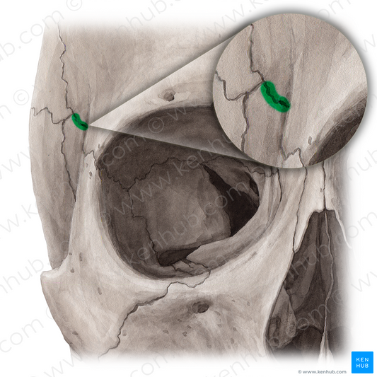 Sphenofrontal suture (#21450)