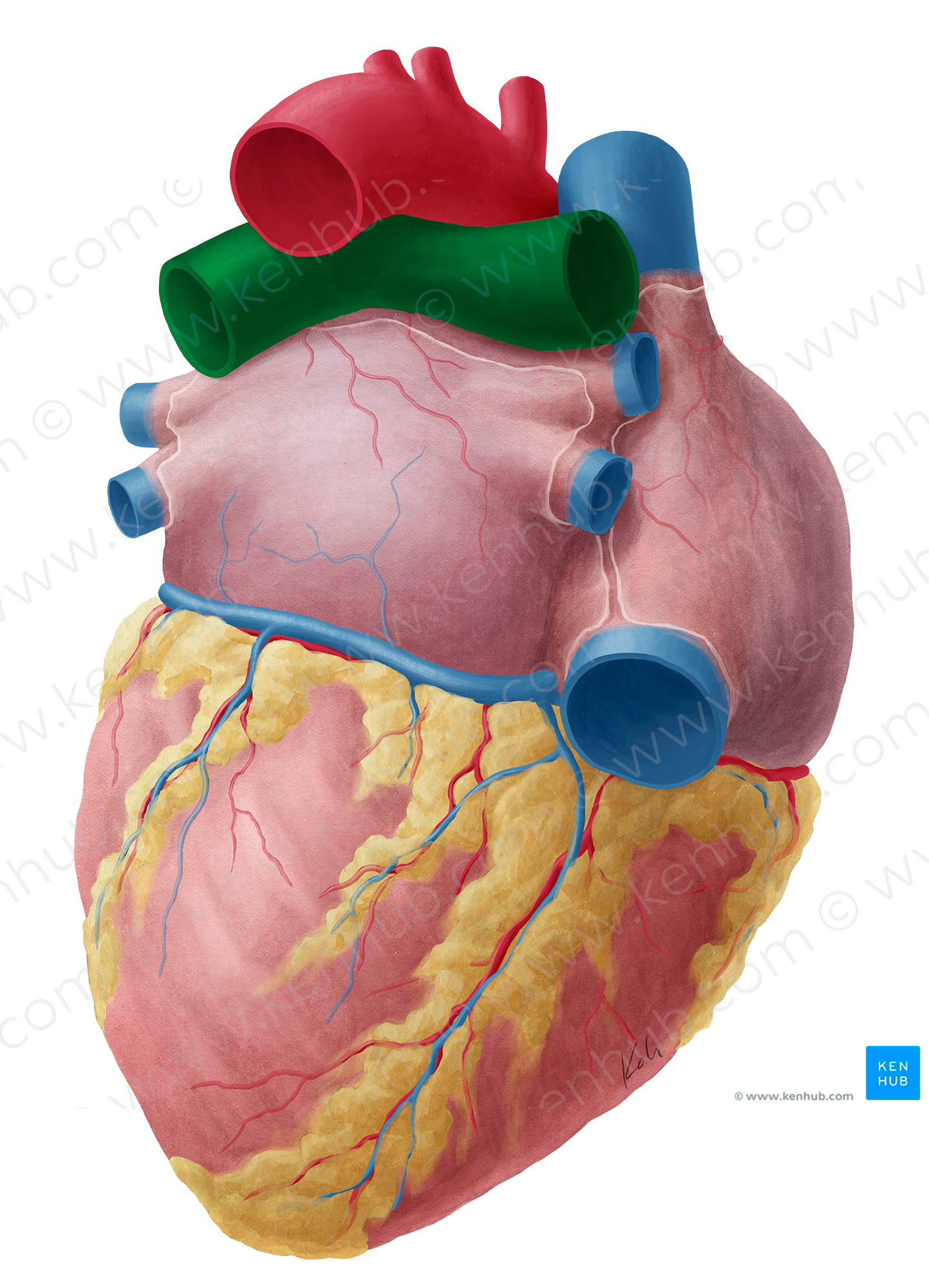 Pulmonary artery (#11596)