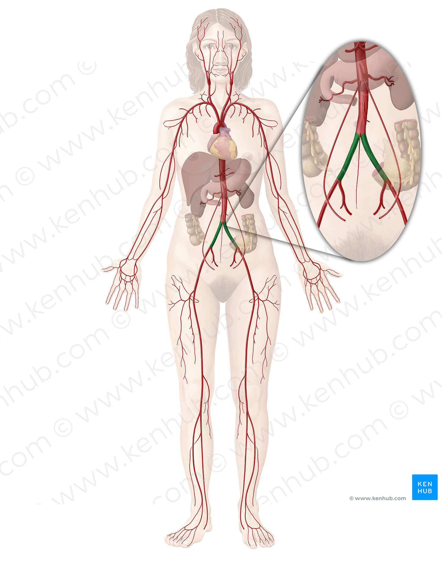 Common iliac artery (#1365)