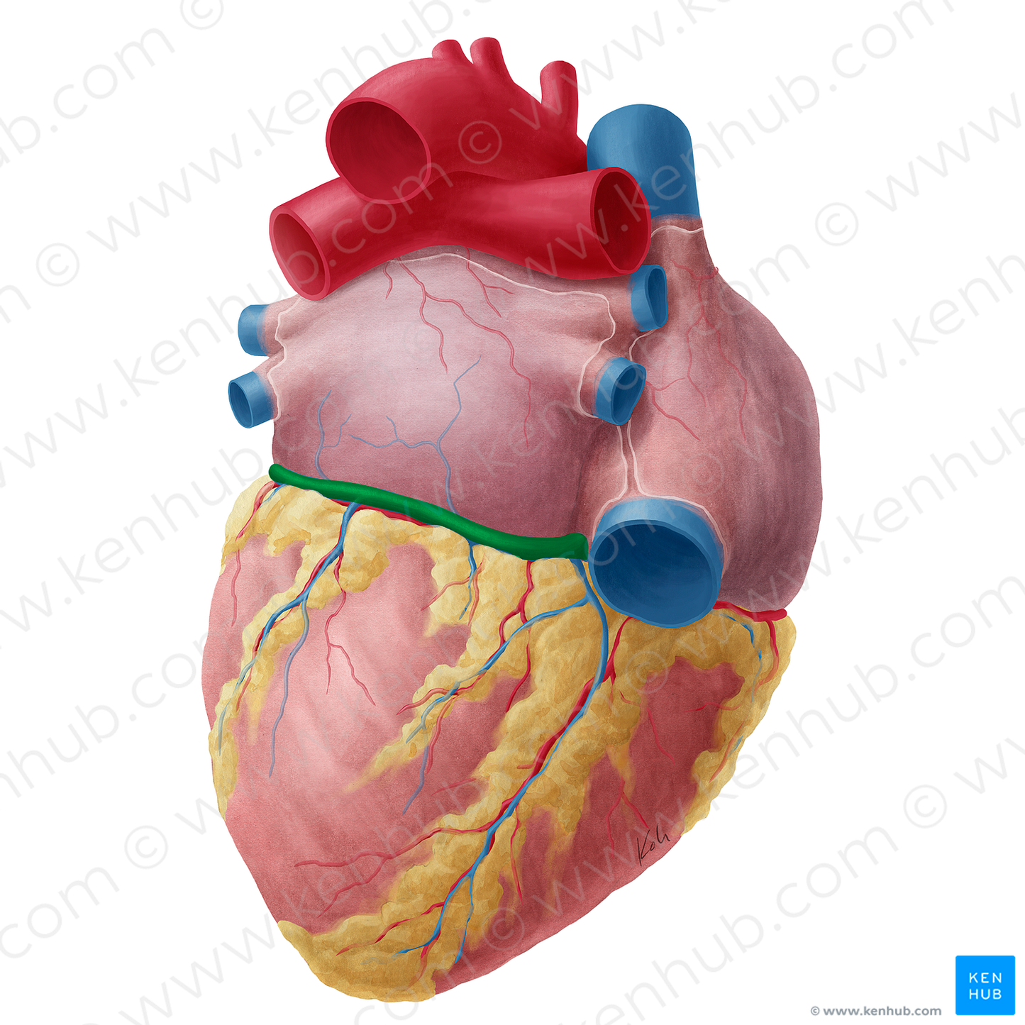 Coronary sinus (#9010)