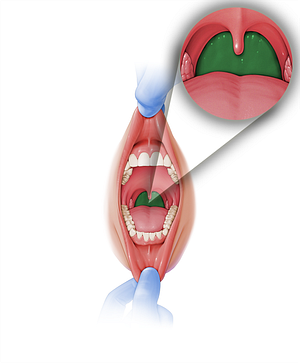 Posterior wall of pharynx (#7650)