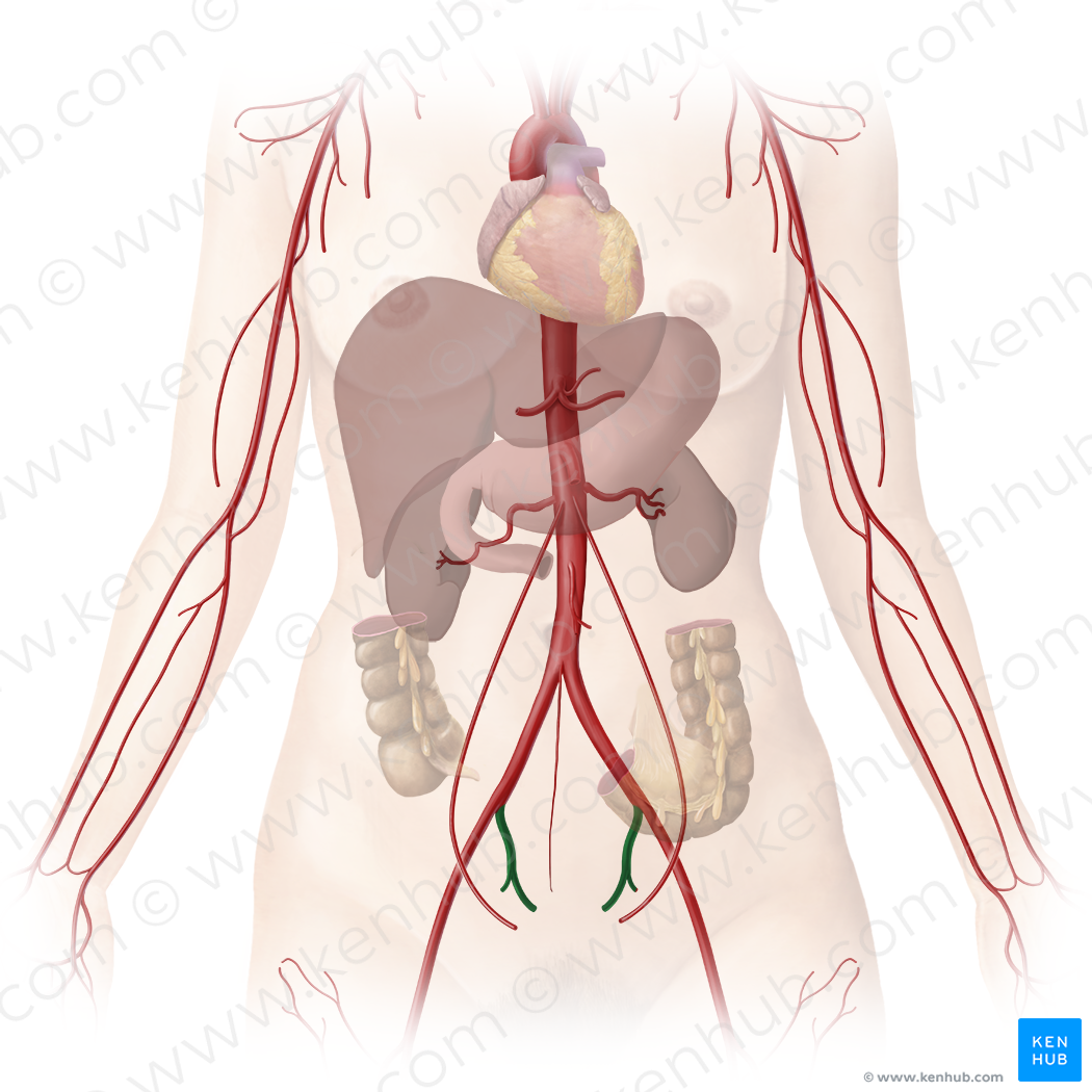 Internal iliac artery (#1421)