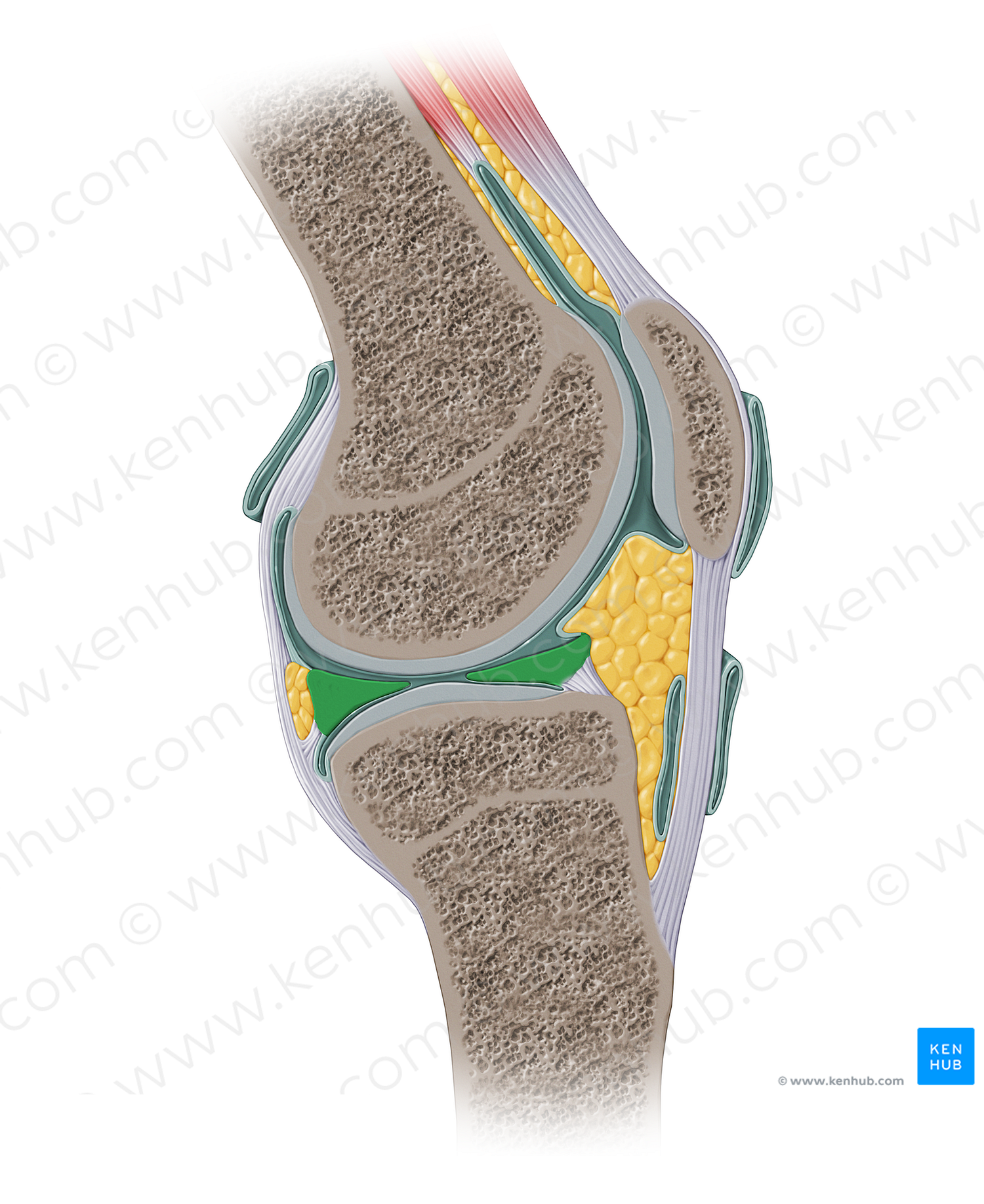 Lateral meniscus (#13922)