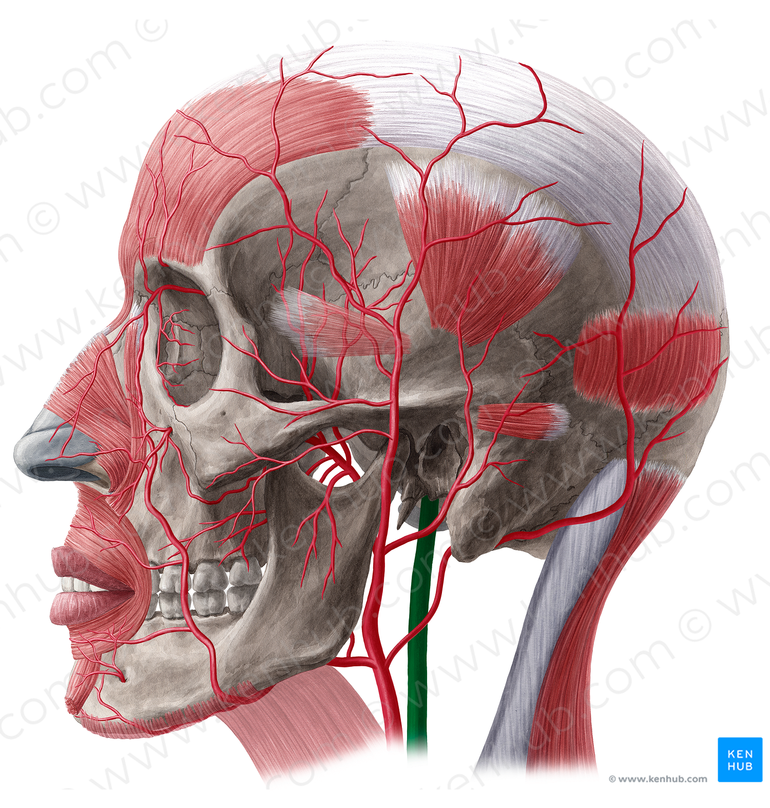 Internal carotid artery (#20511)