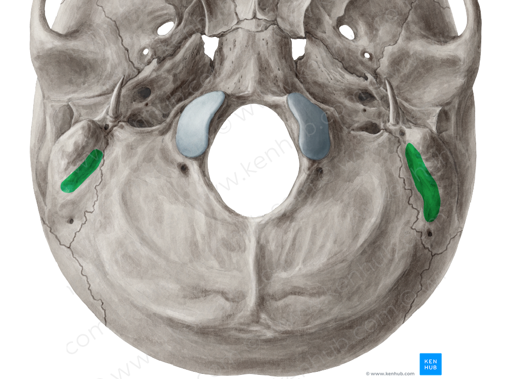 Mastoid notch of temporal bone (#4303)