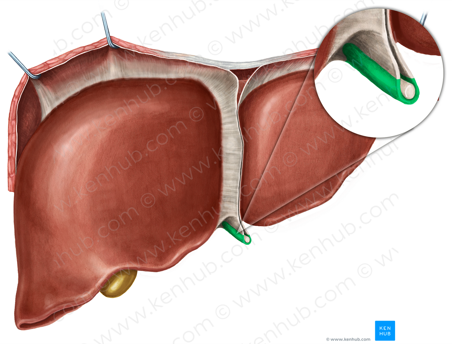 Round ligament of liver (#4629)