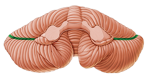 Horizontal fissure of cerebellum (#3652)