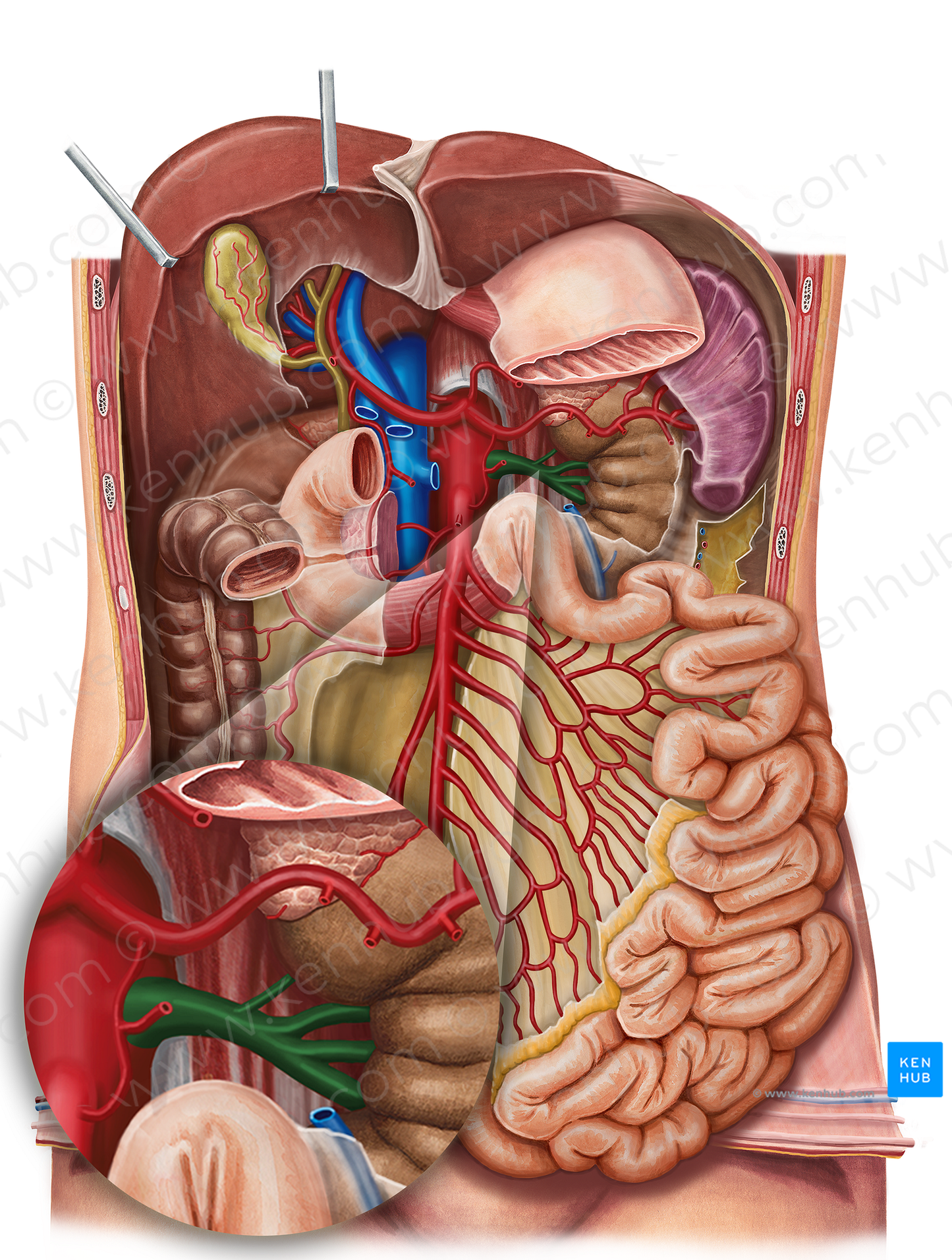 Left renal artery (#1750)