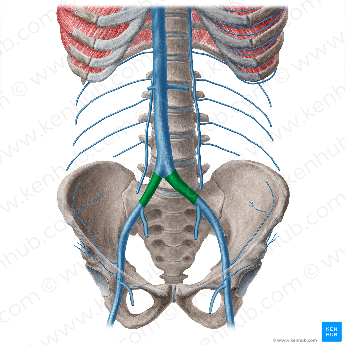 Common iliac vein (#21549)