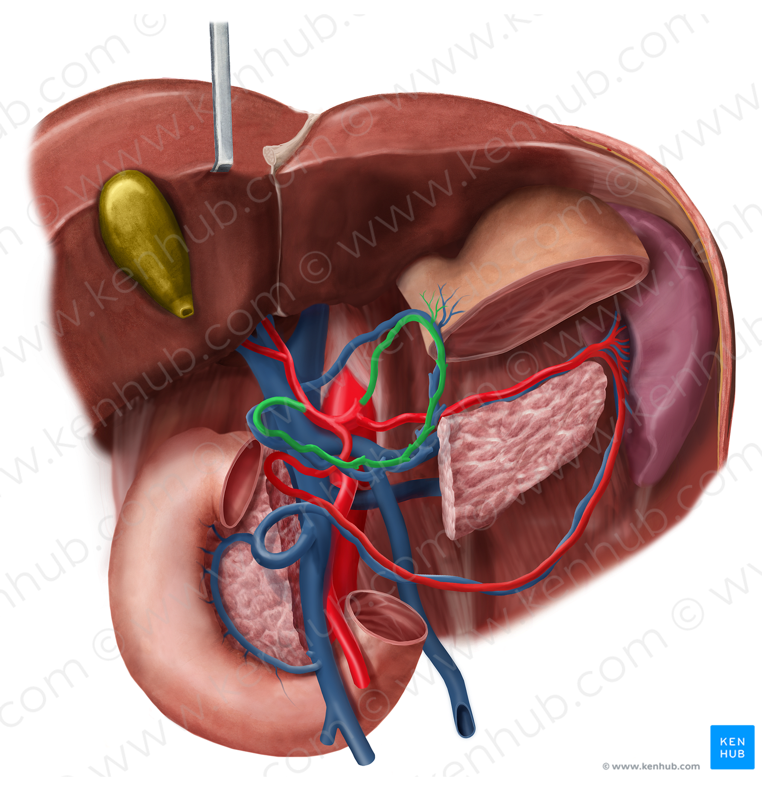 Gastric arteries (#1135)