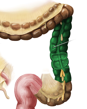 Descending colon (#2732)