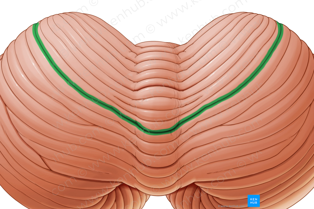 Primary fissure of cerebellum (#3680)
