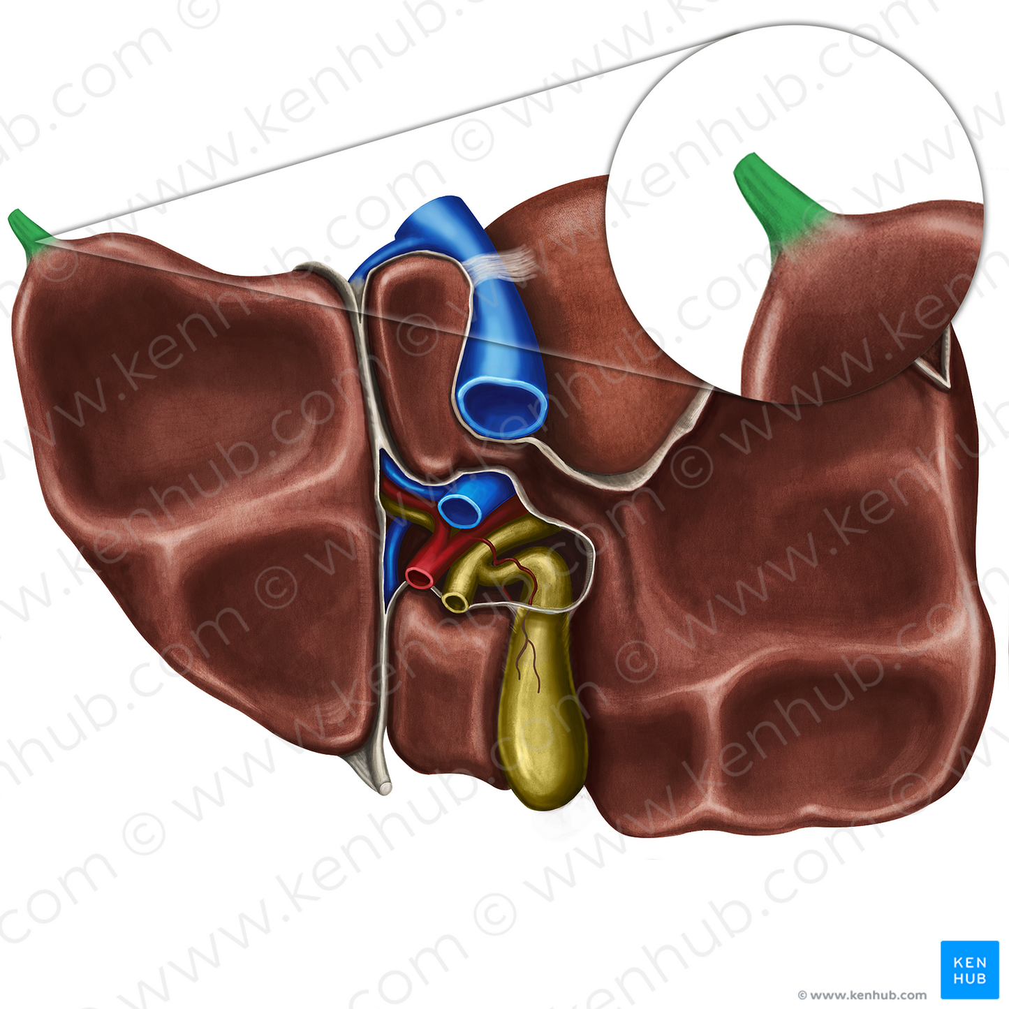 Fibrous appendix of liver (#794)