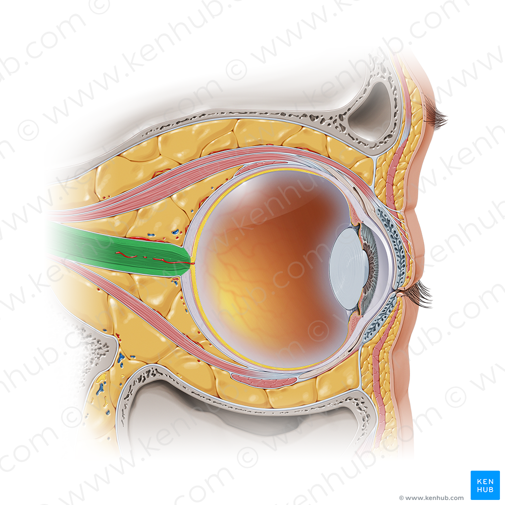 Optic nerve (#6647)