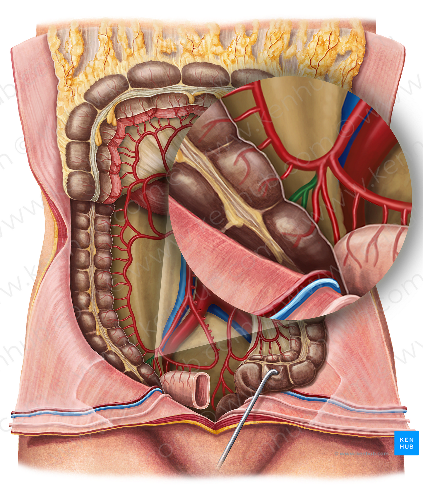 Posterior cecal artery (#921)