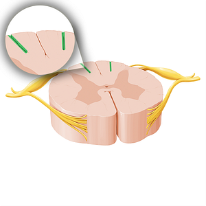 Posterior intermediate sulcus of spinal cord (#20752)