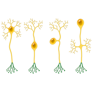 Terminal arborization of axon (#20505)