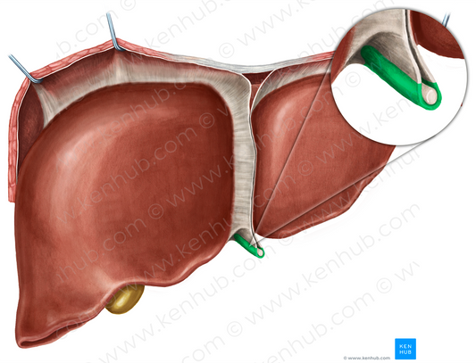 Round ligament of liver (#4634)