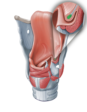 Vestibular ligament (#18366)