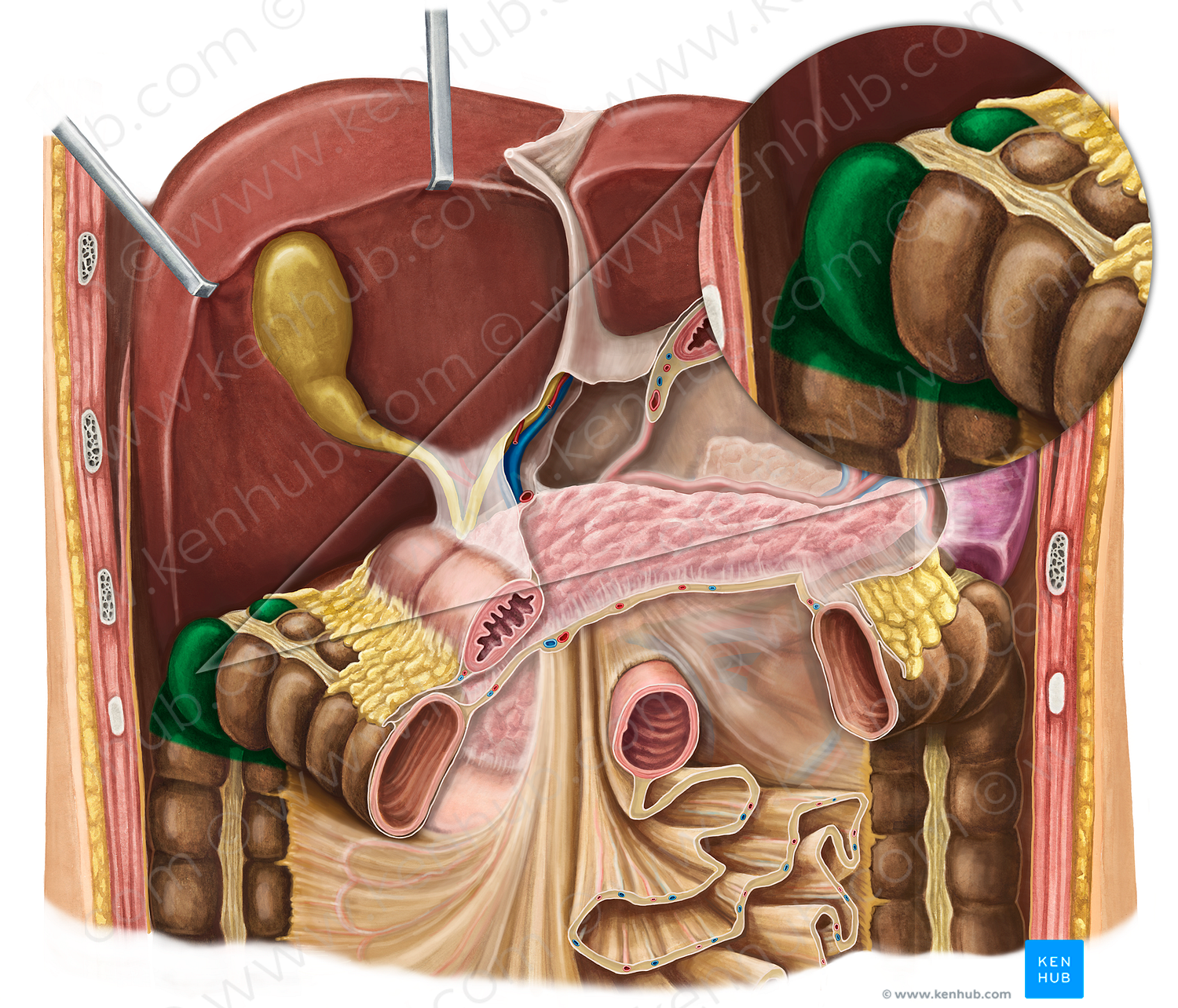 Right colic flexure (#3689)