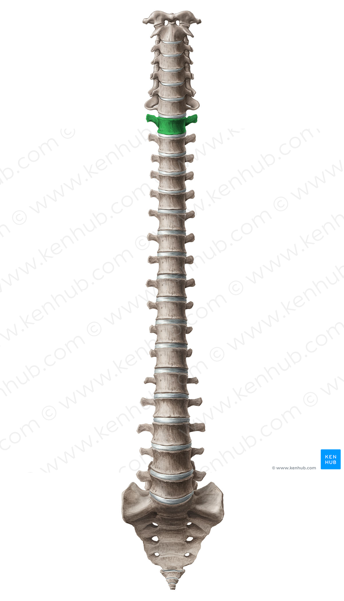 Vertebra T1 (#12594)