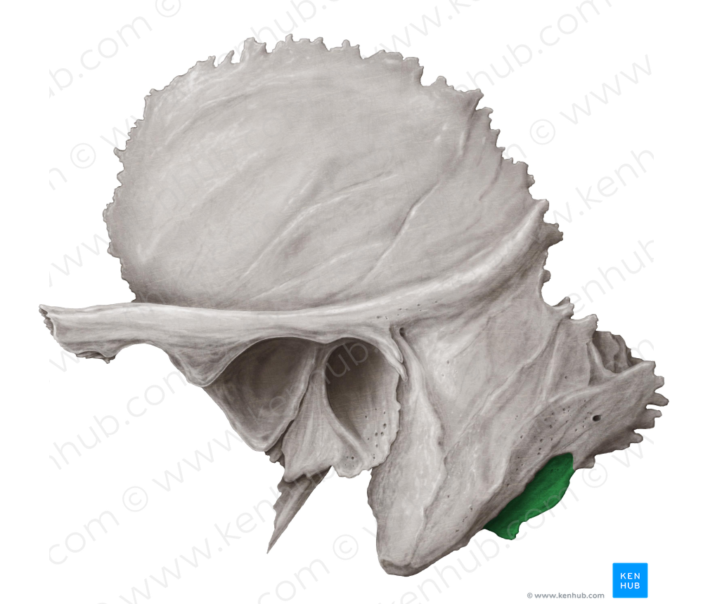 Mastoid notch of temporal bone (#4304)