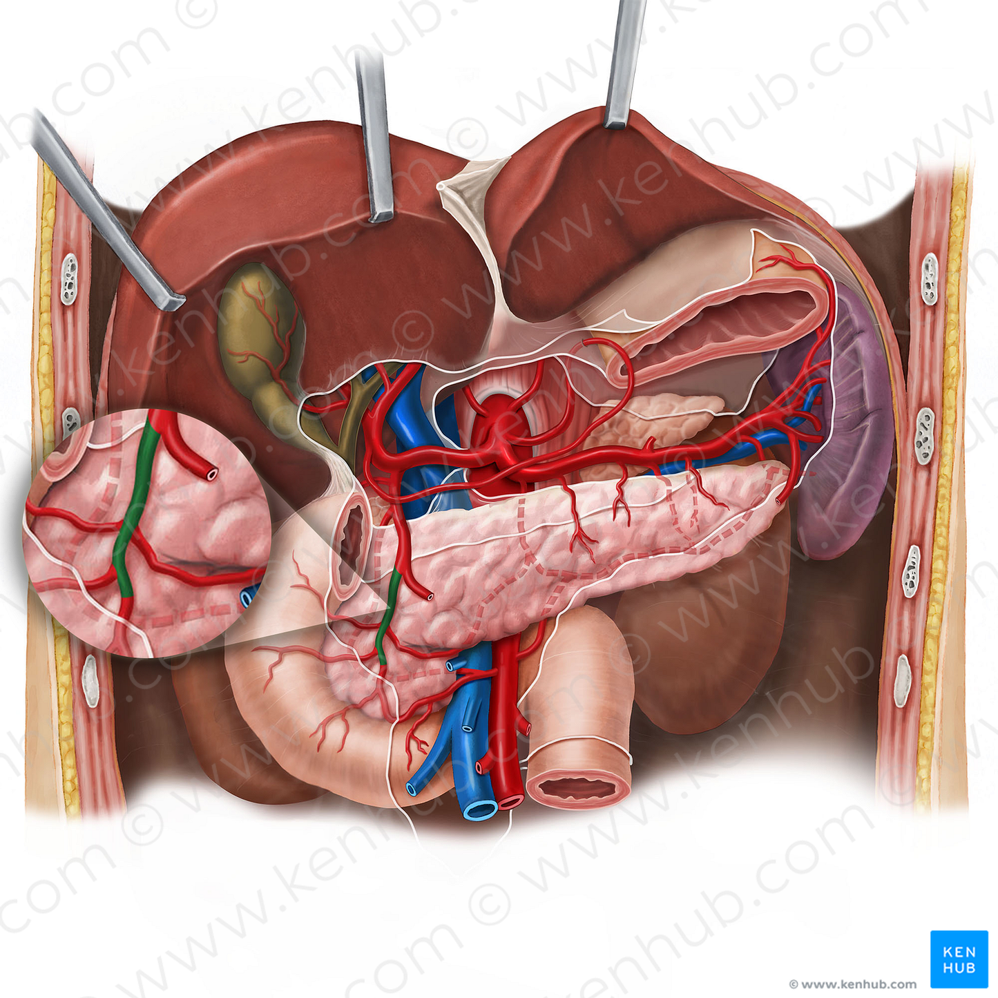 Anterior superior pancreaticoduodenal artery (#1590)