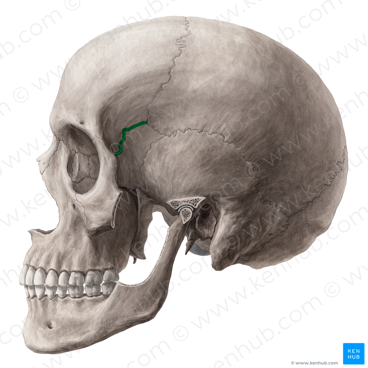 Sphenofrontal suture (#21449)