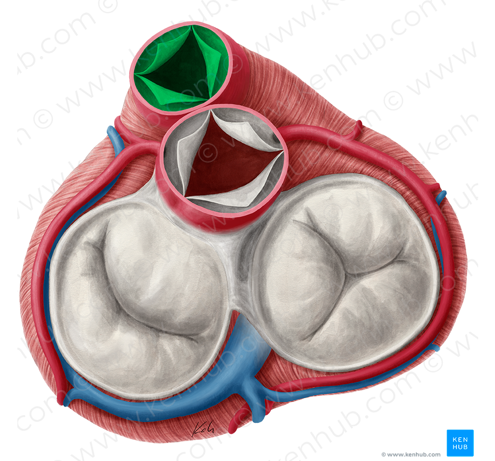 Pulmonary valve (#9914)