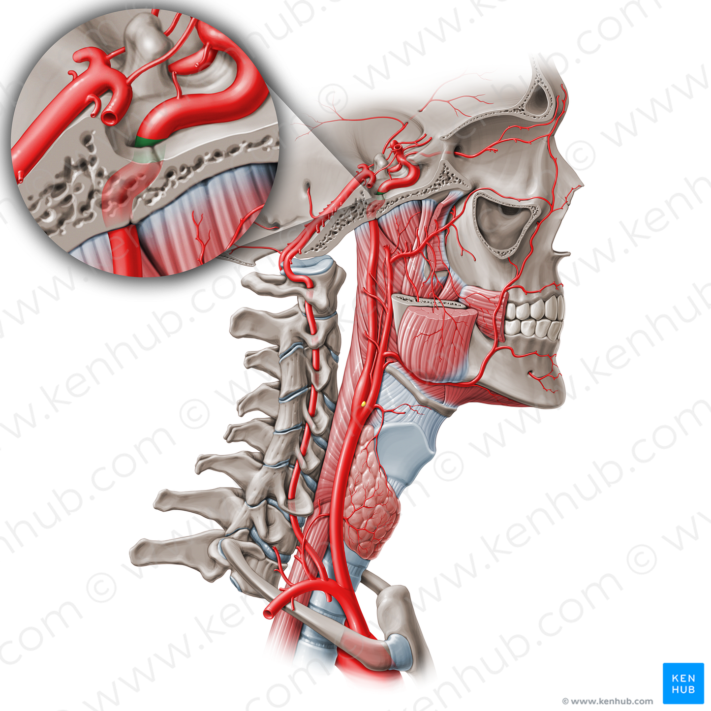 Lacerum part of internal carotid artery (C3) (#19558)