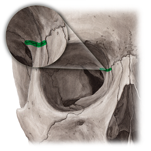 Frontoethmoidal suture (#21460)