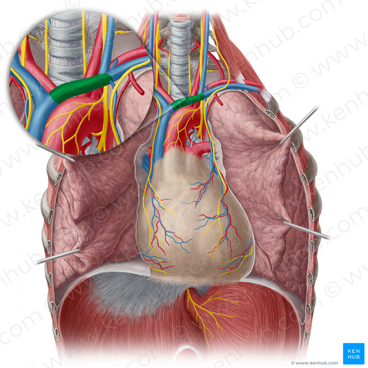 Left brachiocephalic vein (#10012)