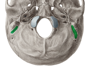 Mastoid notch of temporal bone (#4303)