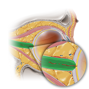 Optic nerve (#6648)