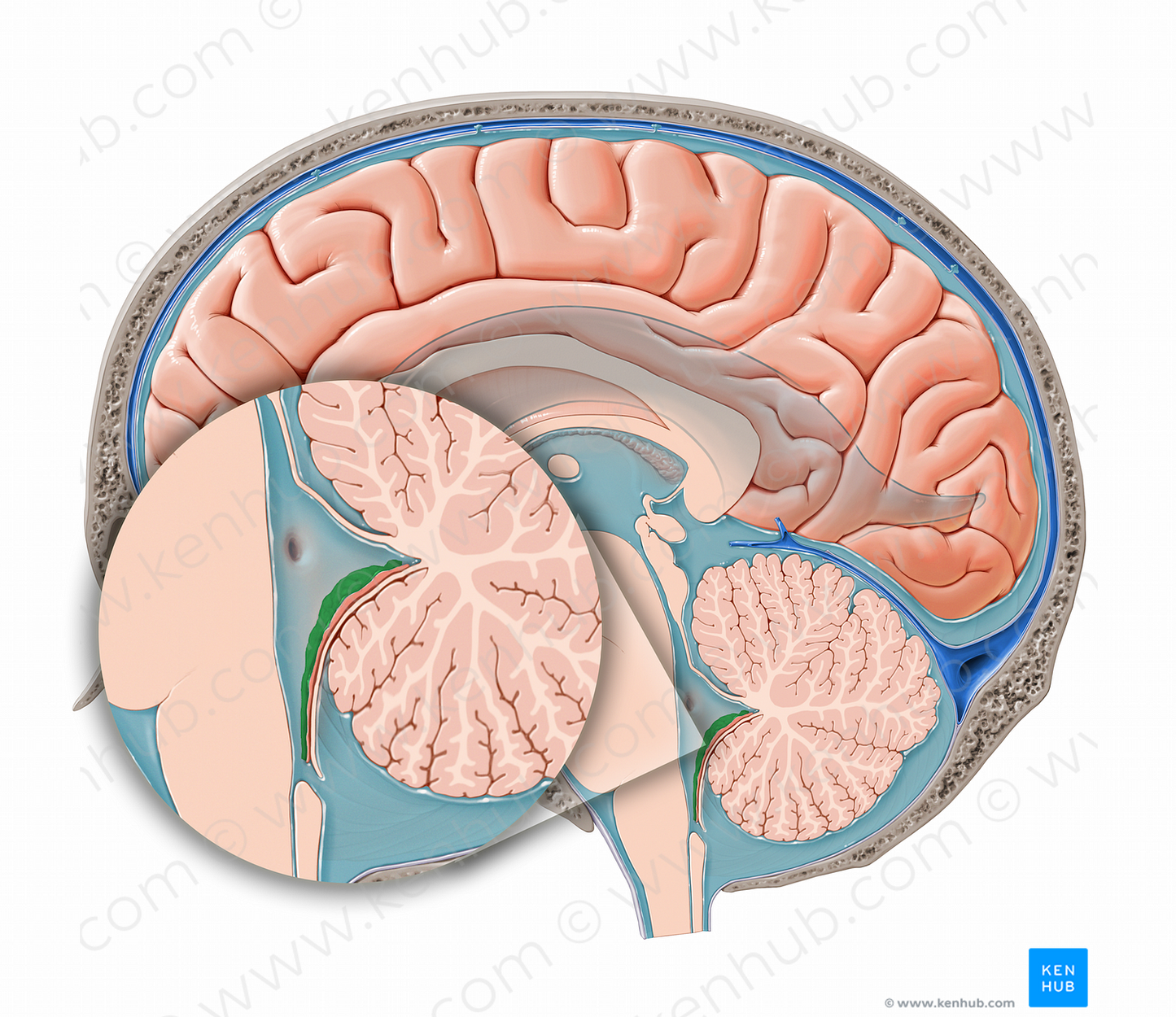 Choroid plexus of fourth ventricle (#12073)