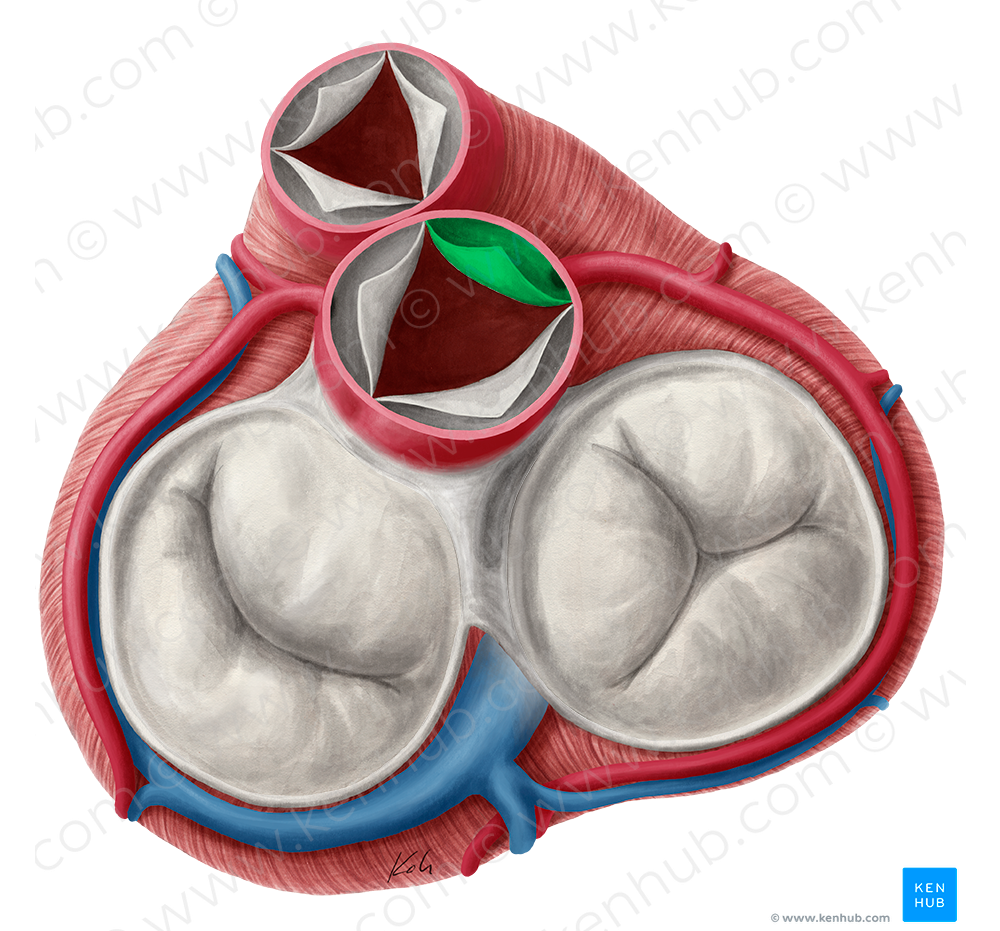 Right coronary leaflet of aortic valve (#9920)