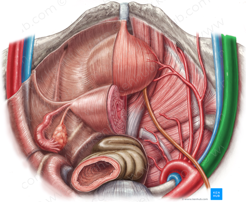 Right external iliac artery (#1403)
